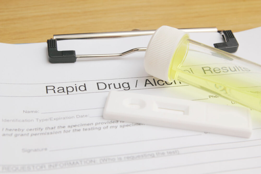 Is Random Drug Testing Legal? Bell Law Group Blog